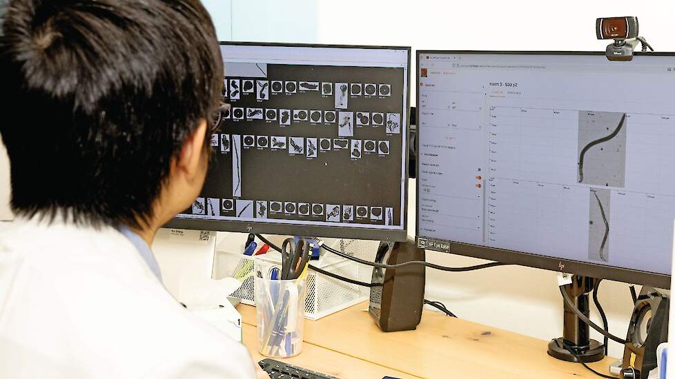 Het verbeteren van het lerend vermogen van het algoritme voor de microscopische analyse bij Antonie.