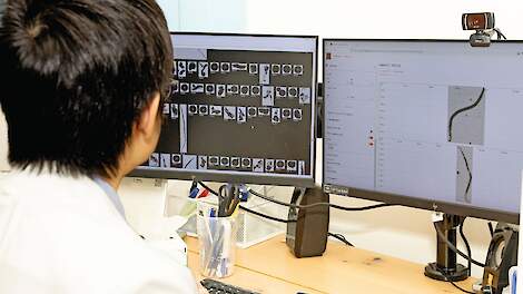 Het verbeteren van het lerend vermogen van het algoritme voor de microscopische analyse bij Antonie.