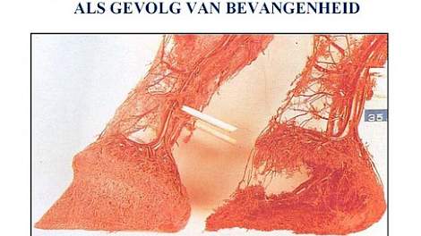 Een verstoorde doorbloeding in de klauw als gevolg van pensverzuring
